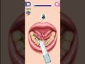 whitening teeth #skincare#teethcare#skincareroutine#skin#skincaretips#teethwhitening#gaming#shorts