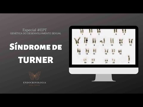 Vídeo: Como tratar a síndrome de Turner: 9 etapas (com fotos)