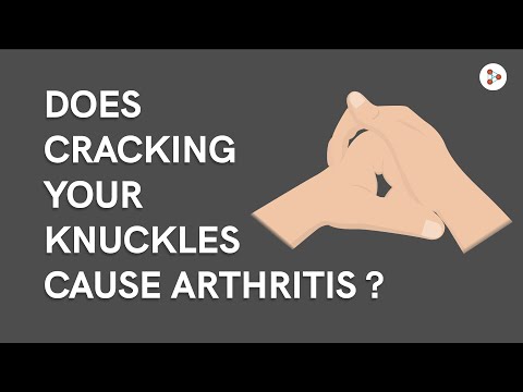 Video: Krekingo jūsų rankos nesukelia artrito