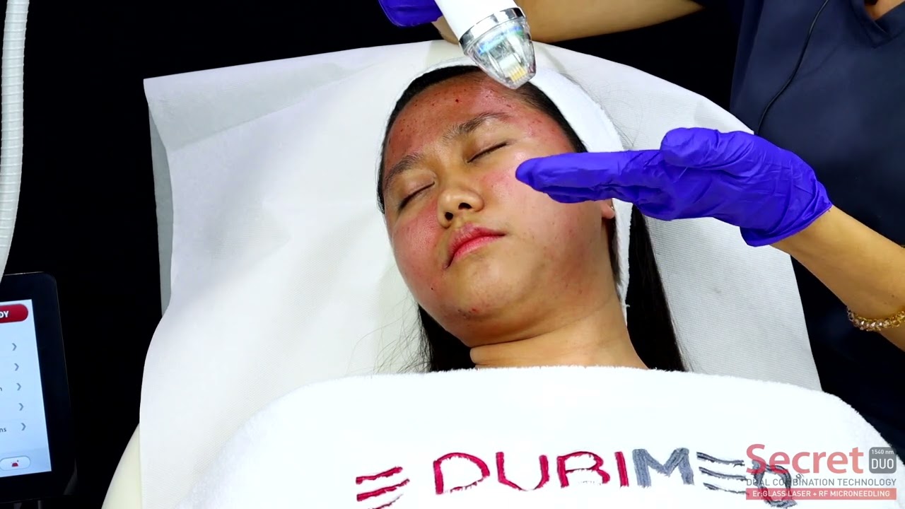 Secret DUO Treatment |  Revolutionary Facial Resurfacing Solution