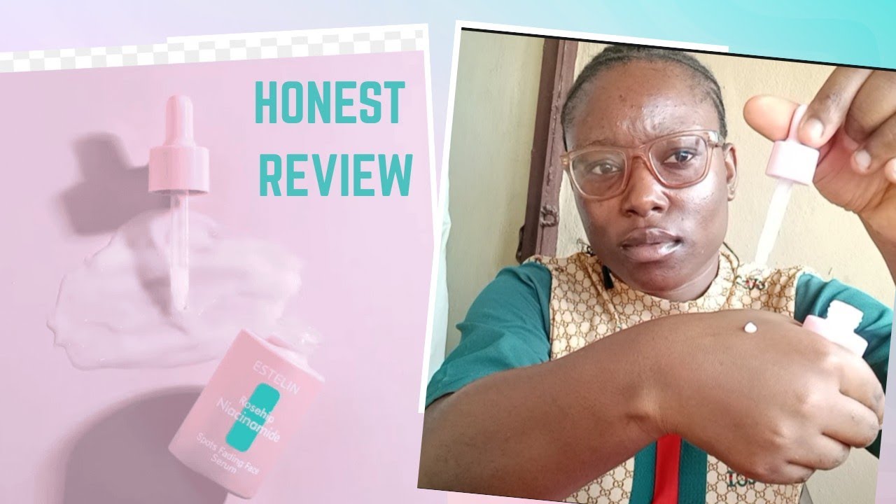 Estelin Niacinamide Serum For Acne & Dark Spots? Affordable & Effective 