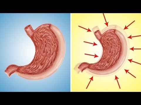 Wideo: Czy Możesz Zmniejszyć żołądek, Jedząc Mniej? Jak Dużo Czasu To Zajmuje?