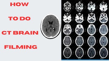 CT Scan Brain Filming Process on Consol Toshiba 16 slice in Urdu|Hindi#ct scan#radiologytechnologis