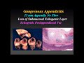 sonography for appendix