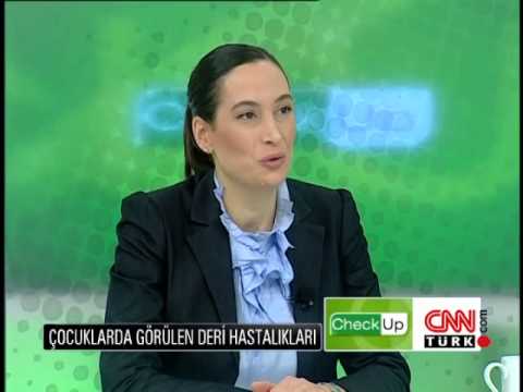 Video: Çocuklarda Siğiller Nasıl Tedavi Edilir