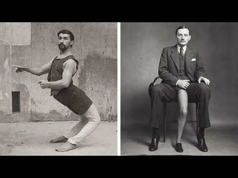 Wideo: Francesco Lentini, mężczyzna z trzema nogami (zdjęcie)