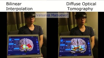 [OBELAB] NIRSIT SFN DOT