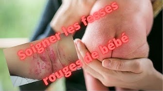 Seringue nasale bébé: finis les rhumes qui trainent! À avoir absolument!  #seringuenasale #rhumebébé 