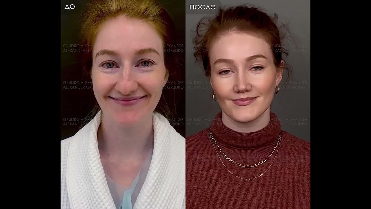 Жизнь до и после ютуб. Жизнь до и после ютуб