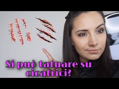 Video: I tatuatori tatueranno sulle cicatrici?