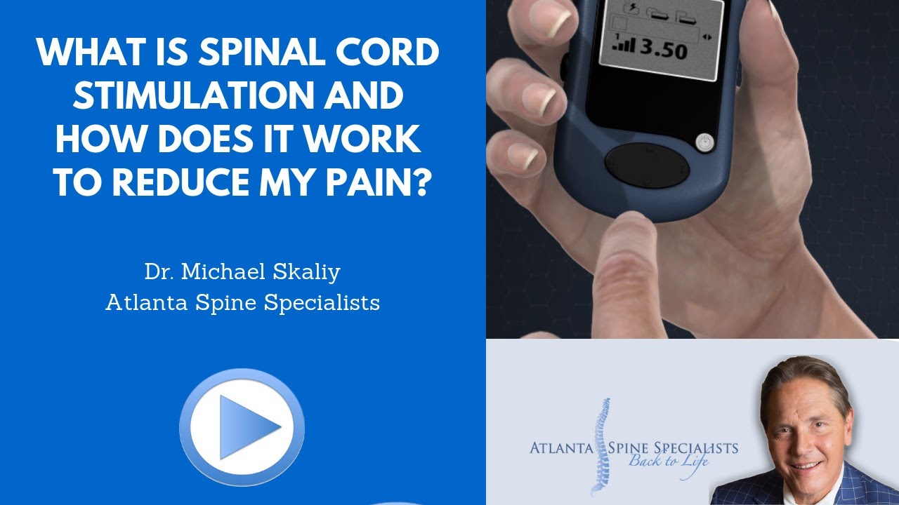 What is permanent spinal cord stimulator? YouTube