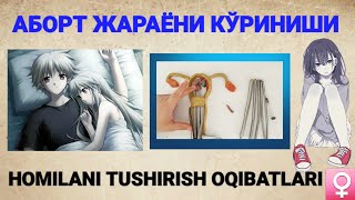 HOMILANI TUSHIRISH — OQIBATLARI / HOMILANI QIRIB OLDIRISH JARAYONI