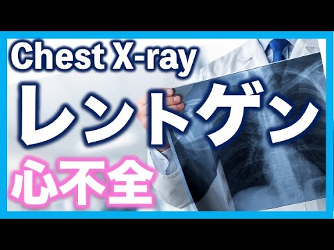 胸部X線　うっ血性心不全のレントゲン 肺水腫　chest X-rays for congestive heart failure