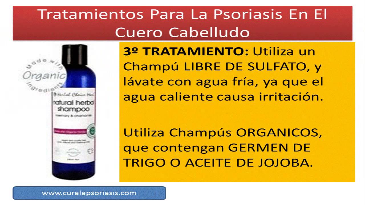 Cómo tratar la psoriasis del cuero cabelludo Cómo tratar la psoriasis del cuero cabelludo