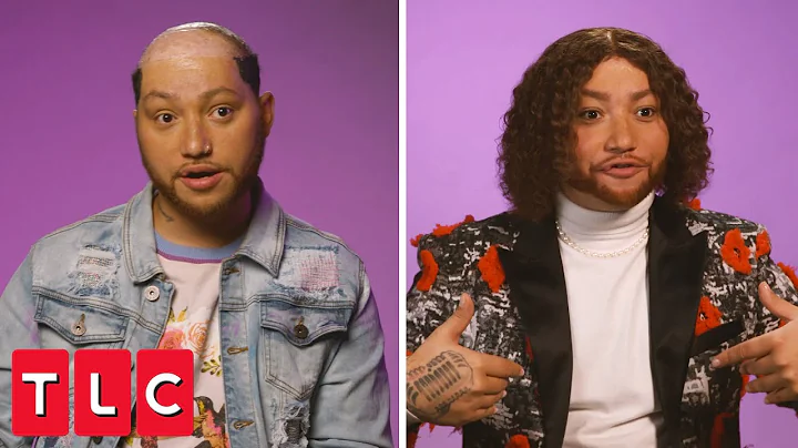 Burn Victim's Incredible Life Changing Hair Restor...
