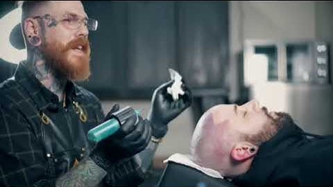 What is Scalp Micropigmentation? By Dallas Scalp Associates