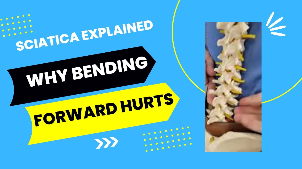 Why Bending Forward Will Not Help Sciatica Explained By Chris