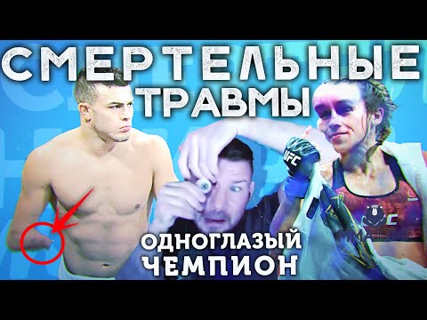 Видео: Велосипедные замки следующего поколения и безопасность