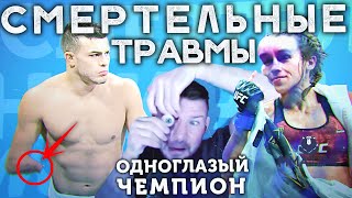 🐻 ТОП 5 БОЙЦОВ ДЕРУЩИХСЯ НЕСМОТРЯ НА ТРАВМЫ