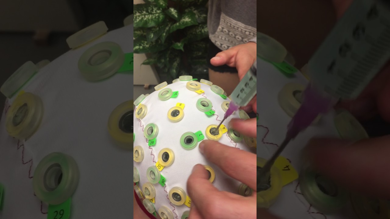 How to fill EEG electrodes and abrade scalp gently with gel using