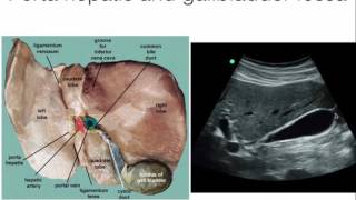 Intro to hepatobiliary ultrasound