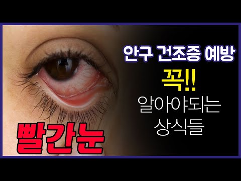 안과: 빨간눈: 알레르기결막염, 눈충혈, 렌즈착용주의점, 블루라이트 차단안경 효과?