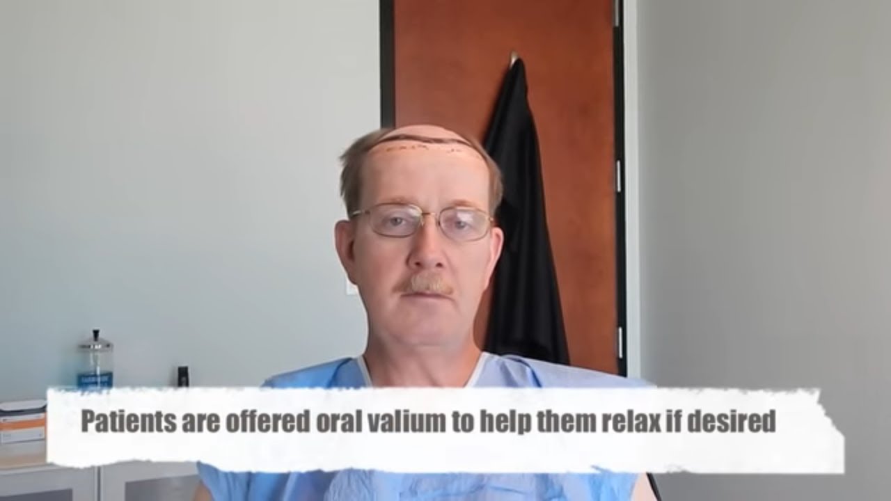 Hair Transplant Before and After - Patient with Dr. Matt Huebner