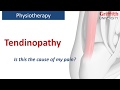 Physiotherapy for Tendinopathy - Griffith Physiotherapy Clinic