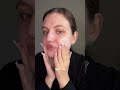 Крем Stop Acne #WW114934 (WB) #1868802156(OZON)