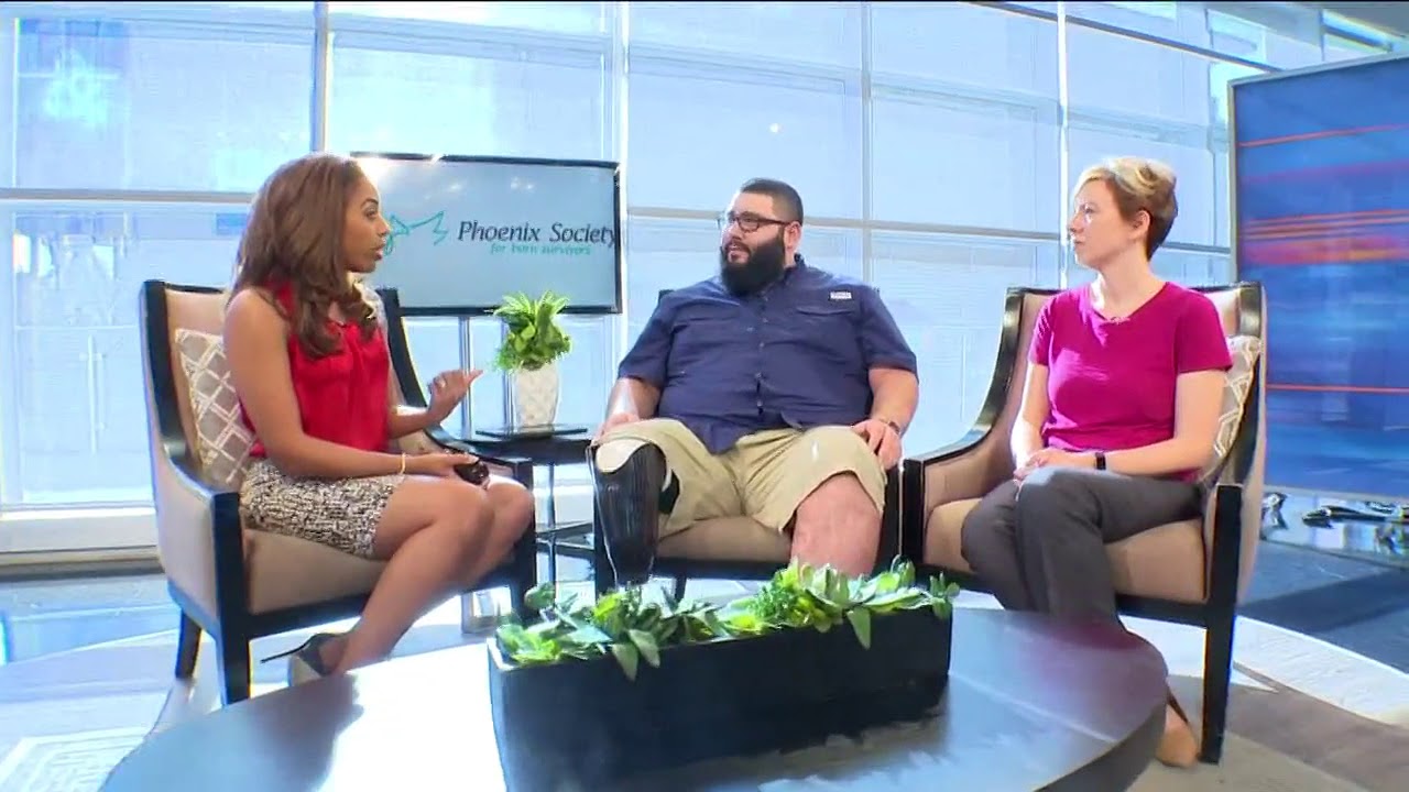 Dallas hosting Phoenix World Burn Congress