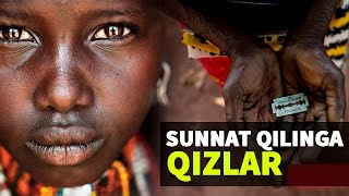 Sunnat qilingan qizlar: Buni ko'rib qo'rquv bosadi kishini