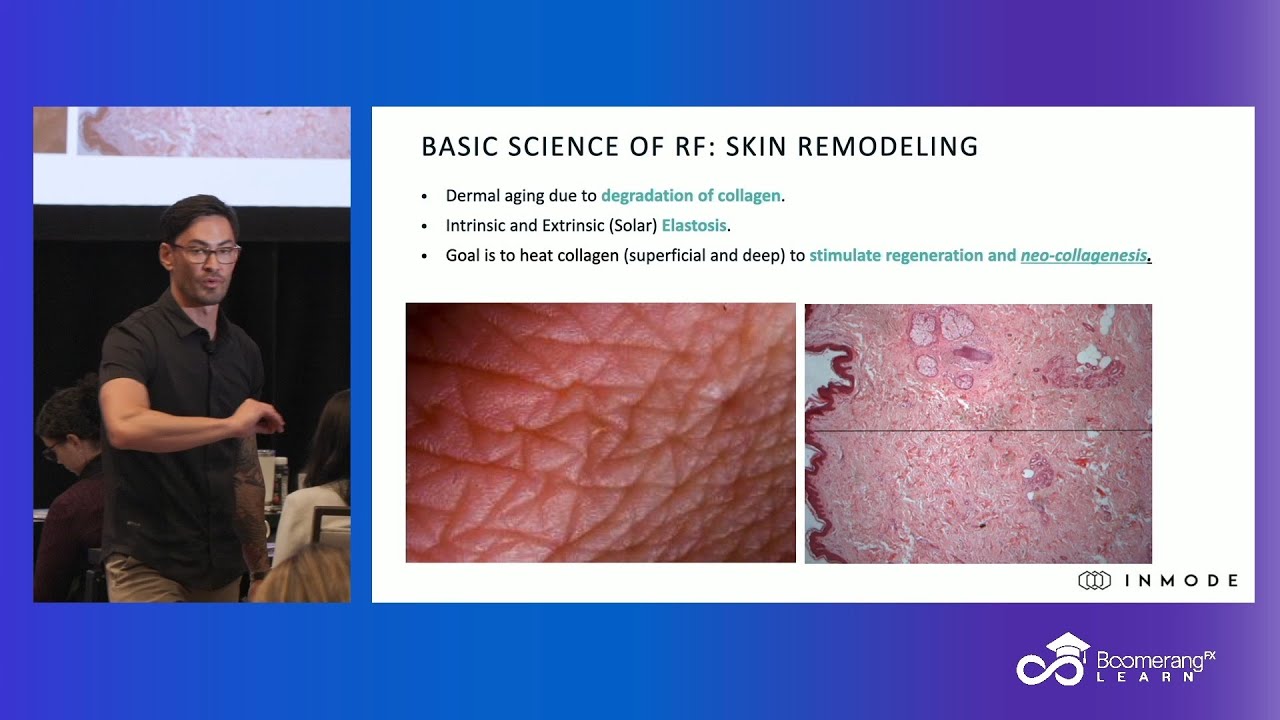Maningas 💡 Forma Explained: Dr. Maningas on Skin Tightening & Tissue Remodeling ...