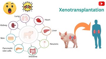 Xenotransplantation Research - Where Are We At? (3 Minutes Microlearning)
