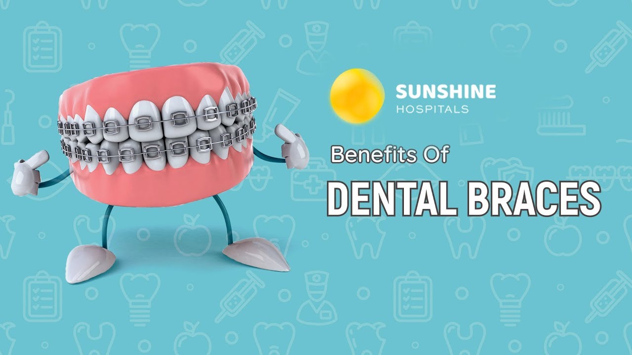 5 Benefits Of Wearing Braces Sunshine YouTube