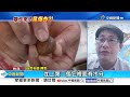 &quot;糖炒栗子&quot;會爆炸?! 扔出如&quot;甩砲&quot;咬一口&quot;險炸爛臉&quot;!│中視新聞 20240215