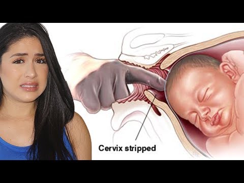 My Membrane Sweep Did It Work Youtube