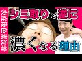 【シミ取りの悲劇】レーザー治療しない方がいい人の特徴を解説します【肝斑治療が厄介な理由】湘南美容クリニック