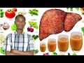 Ngibi Ibiribwa Abarwayi B Umwijima Bose Bakwiriye Kurya Birinda Uburwayi Bw Umwijima Ngibi Ibiribwa Abarwayi B Umwijima Bose Bakwiriye Kurya Birinda Uburwayi Bw Umwijima
