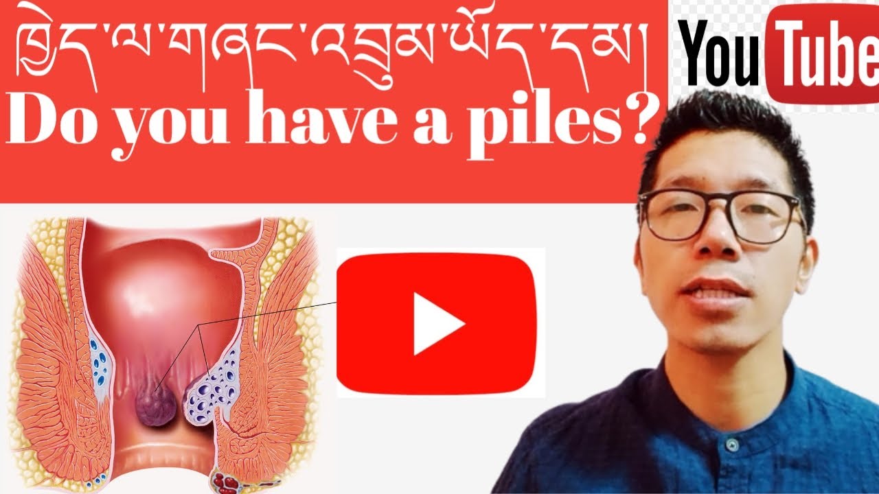 གཞང་འབྲུམ་འབྱུང་རྐྱེན།(Piles)||སྨན་བཅོས།||སྔོན་འགོག་ཐབས་ལམ་ལྔ།||Sowa-Rigpa