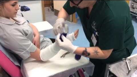 Application of scaphoid cast