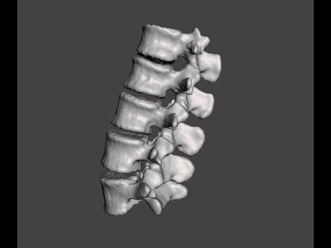 anatomy of lumbar vertebrae شرح تشريح الفقرات القطنية