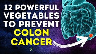 12 Powerful Vegetables To Prevent Colon Cancer by MLC 27,987 views 5 months ago 24 minutes