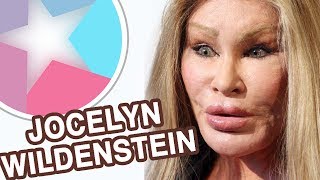 Jocelyn Wildenstein Before And After | Then And Now | Changing Face