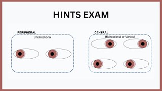 Hints Exam Explained