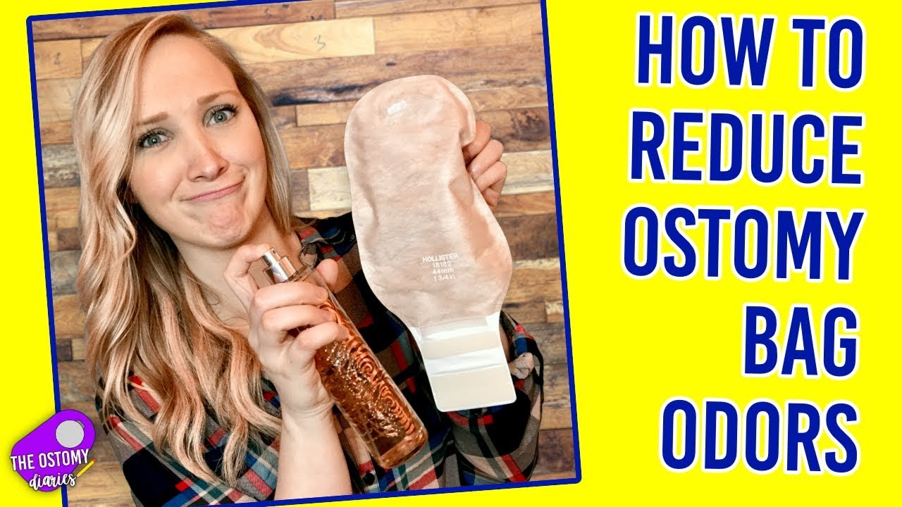 Hollister Ostomy Pouch Hack - OSTOMY TIP (w/ video)