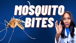 How to Prevent Mosquito ? Bites! (This Might Surprise You!) A Doctor Explains
