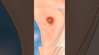 😯ASMR Treatment Animation | Armpit Cleaning Satisfying Animation #asmranimation #viral #asmrsounds