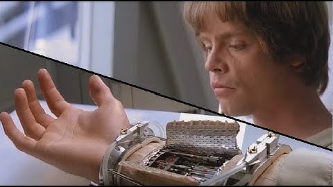 Luke gets his new hand, but robot advises