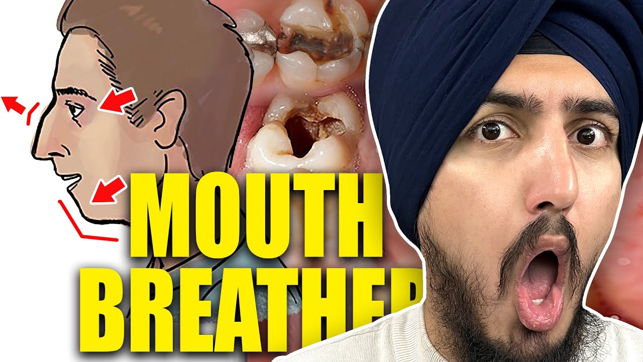7 Signs You Are A MOUTH Breather (And Why Nose Breathing Is Better