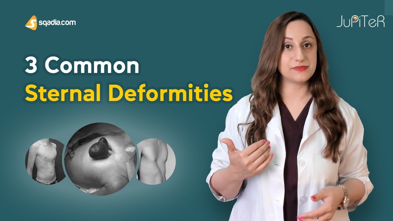 Sternum | Bone Anatomy | 3 Common Sternal Deformities | Skeletal System